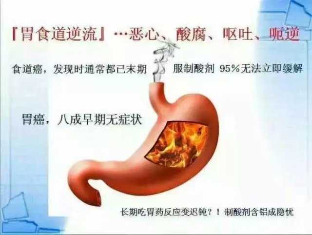 胃反流圖片.png